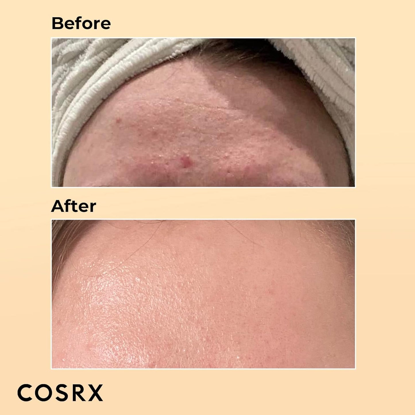 Cosrx  COSRX Advanced Snail 96 Mucin Power Essence